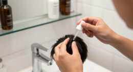 12 Best Hair Loss Treatments in 2026
